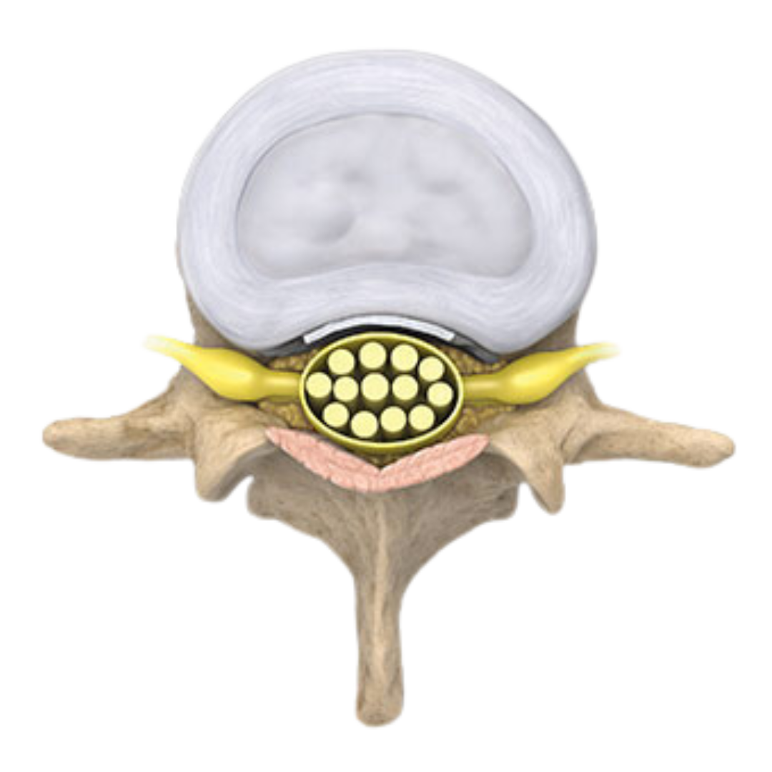 HEALTHY, OPEN SPINAL CANAL healthy, open spinal canal