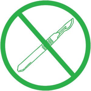Sprint_Incision Free green icon of a scalpel being crossed out indicating that Sprint treatment is incision-free
